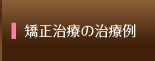 矯正治療の治療例