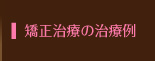 矯正治療の治療例